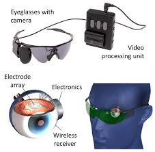Working of Argus-II Retinal Prosthesis System