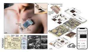 Wearable Ultrasound System